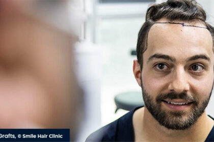 istanbul-is-the-best-place-for-hair-restoration-in-turkey-for-hair-transplantation